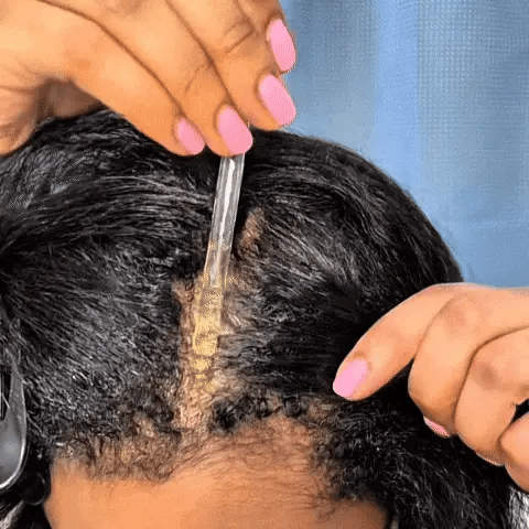 🔥50% OFF🔥 🌿 Advanced Batana Hair Regrowth Therapy ✨