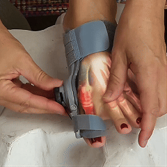 🔥50% OFF🔥 🦶 Adjustable Bunion Corrector Toe Separator (Day & Night Use) ✨