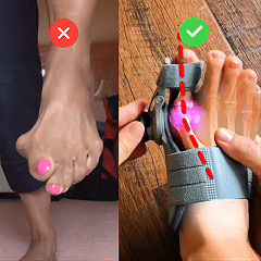 🔥50% OFF🔥 🦶 Adjustable Bunion Corrector Toe Separator (Day & Night Use) ✨
