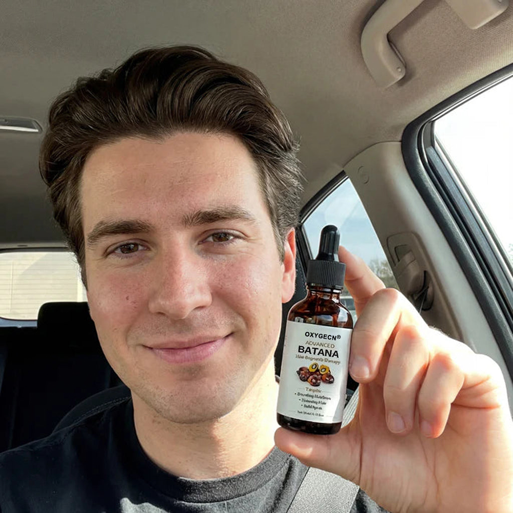 🔥50% OFF🔥 🌿 Advanced Batana Hair Regrowth Therapy ✨