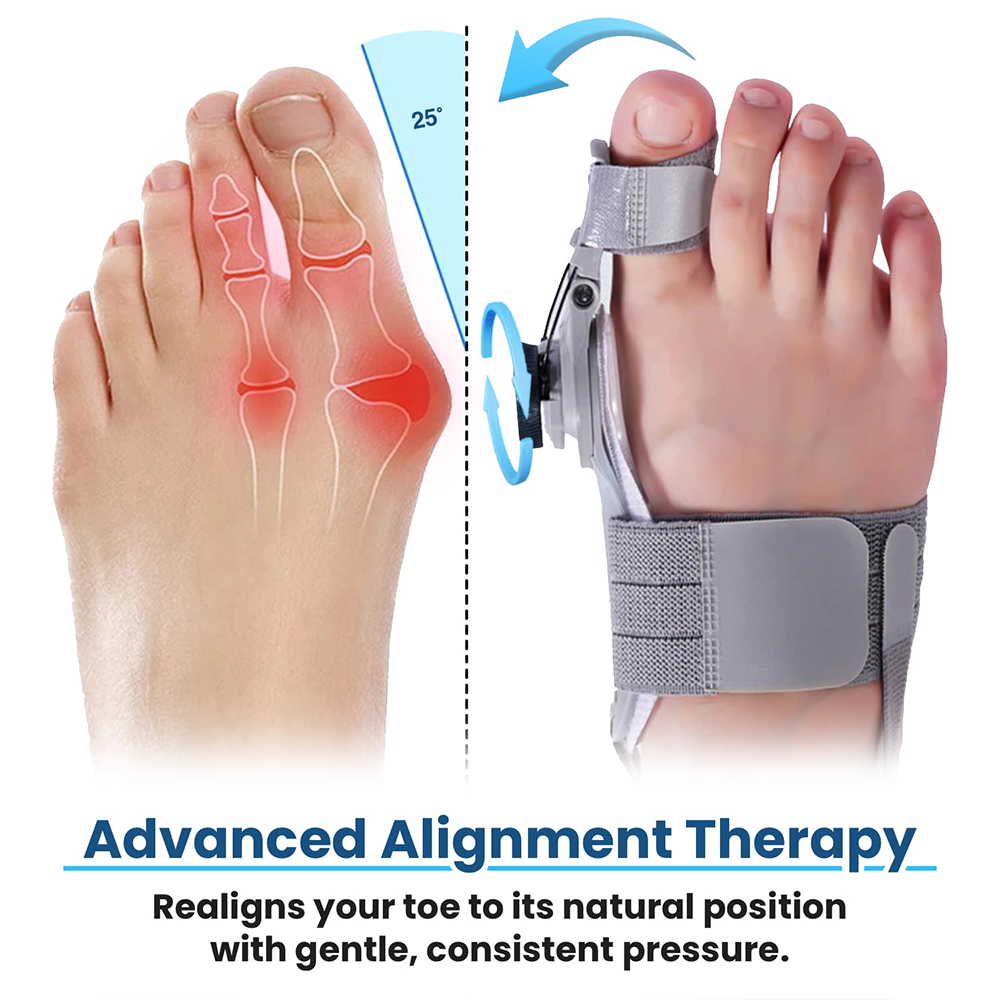 🔥50% OFF🔥 🦶 Adjustable Bunion Corrector Toe Separator (Day & Night Use) ✨