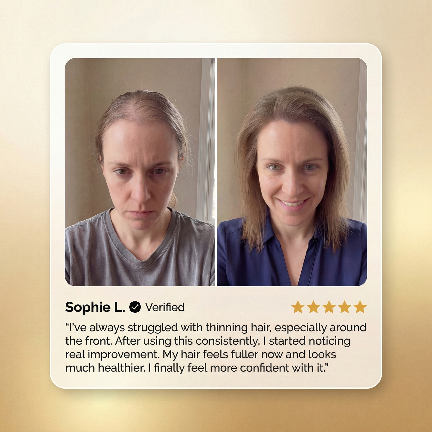 🔥50% OFF🔥 🌿 Advanced Batana Hair Regrowth Therapy ✨
