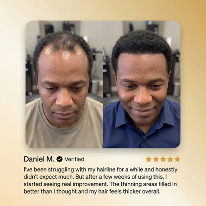 🔥50% OFF🔥 🌿 Advanced Batana Hair Regrowth Therapy ✨