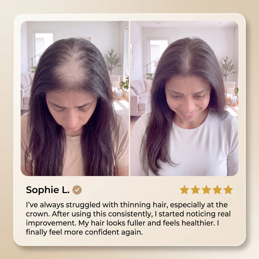 🔥50% OFF🔥 🌿 Advanced Batana Hair Regrowth Therapy ✨