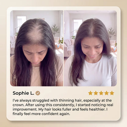 🔥50% OFF🔥 🌿 Advanced Batana Hair Regrowth Therapy ✨